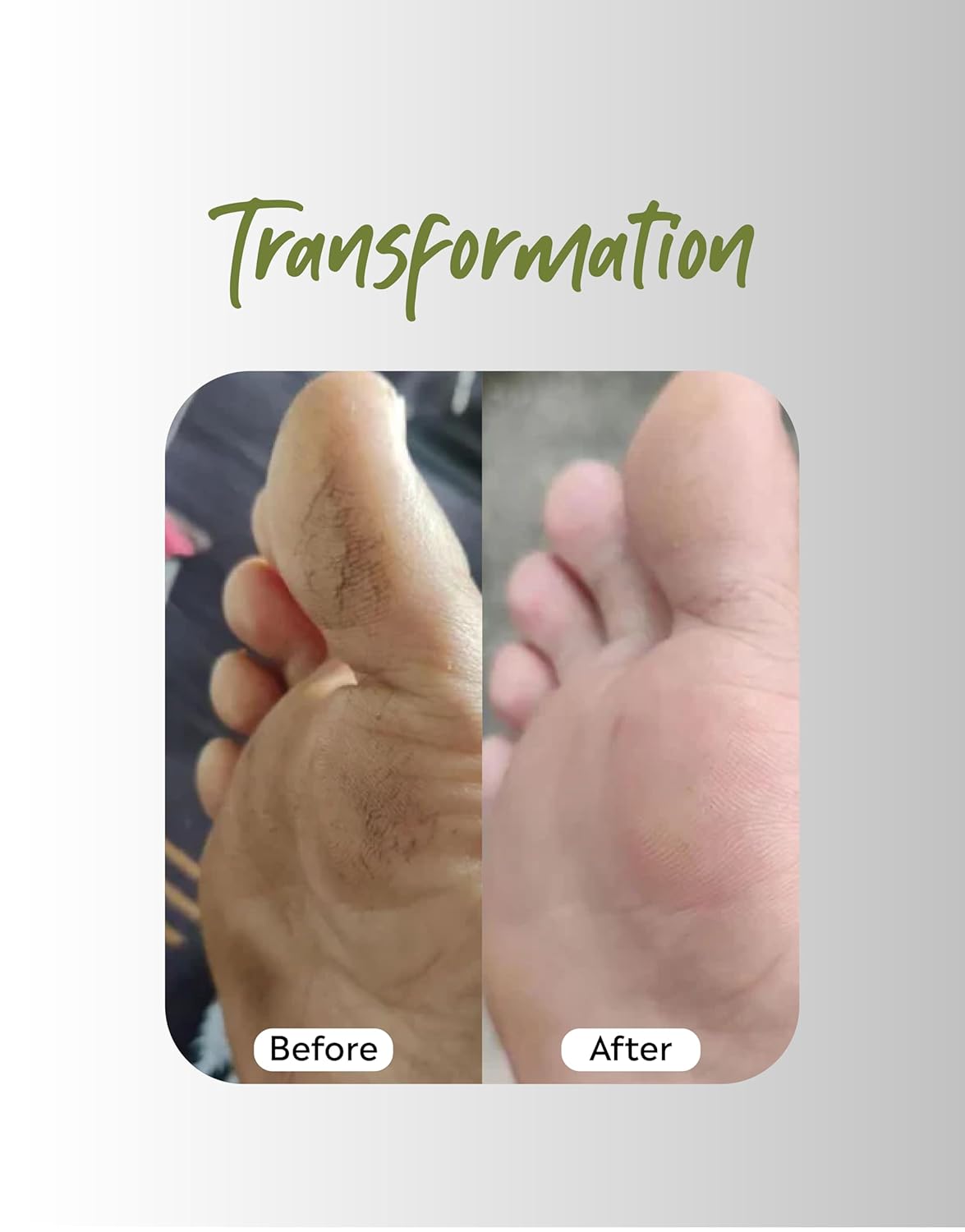 Foot Cream | For Dry, Rough, And Cracked Feet | Moisturizes Rough Heels | Suits both Men & Women | 40 Grm - Deyga Natural Skincare